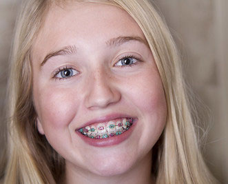 orthodontic faqs